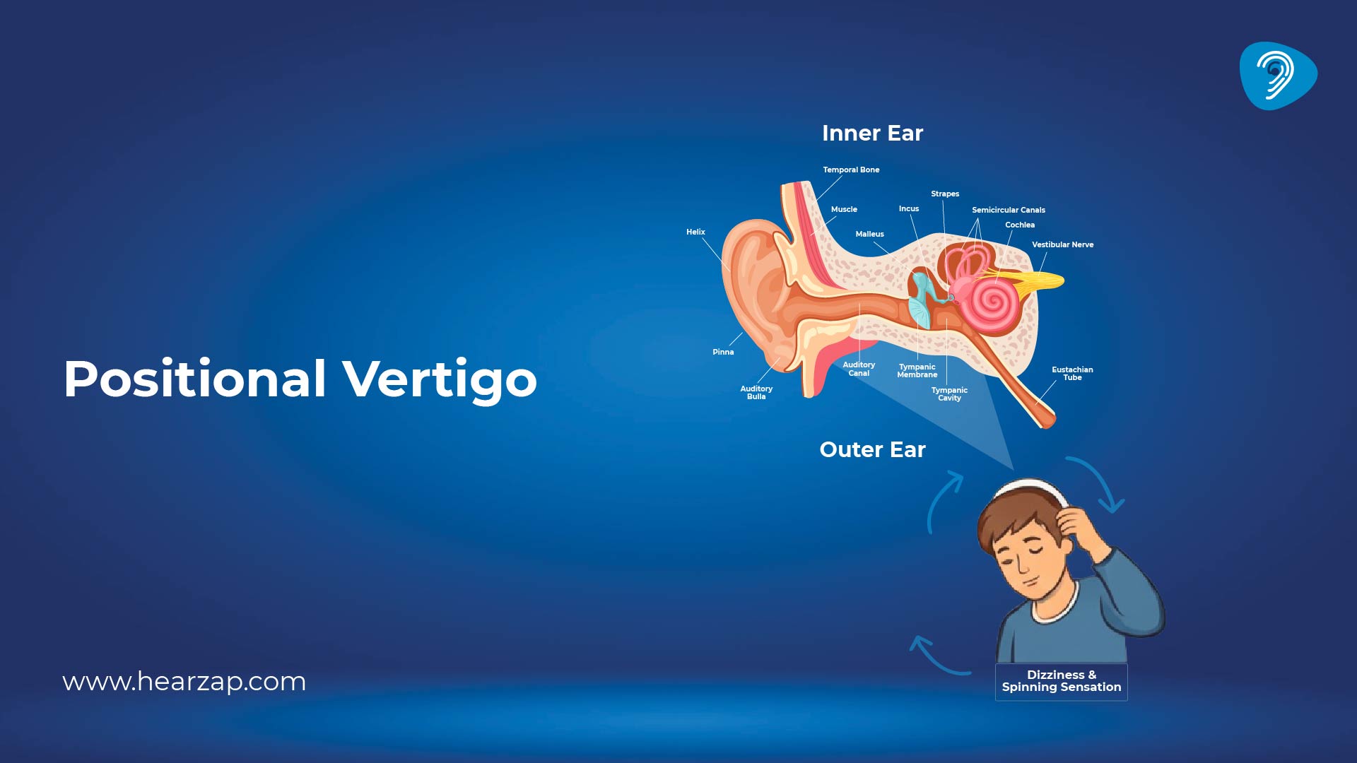 Ucapkan Selamat Tinggal kepada Vertigo dengan TSA